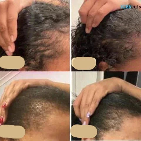 Hårvækstolie til kvinder | Naturlig Hårpleje 1