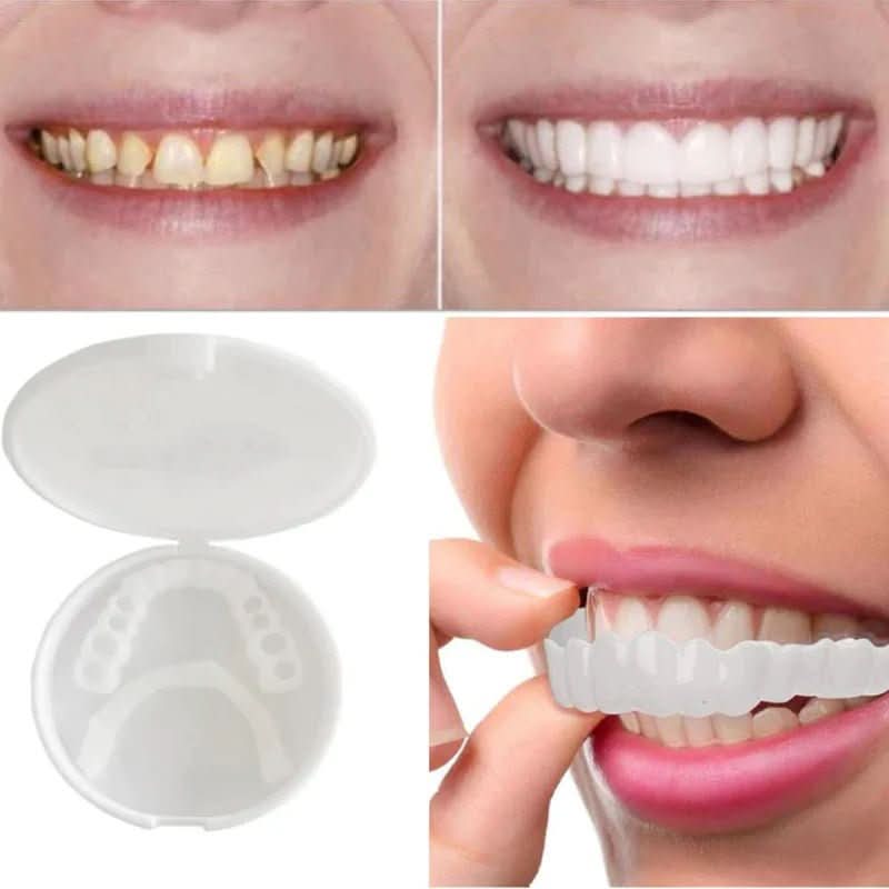 Voksne Tandfiner til Blændende Smil 3